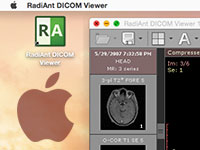 Blog image - RadiAnt on Mac